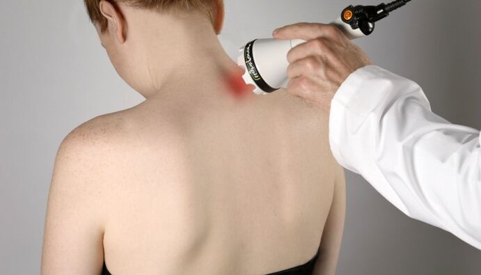 Terapia con láser para osteocondrose cervical